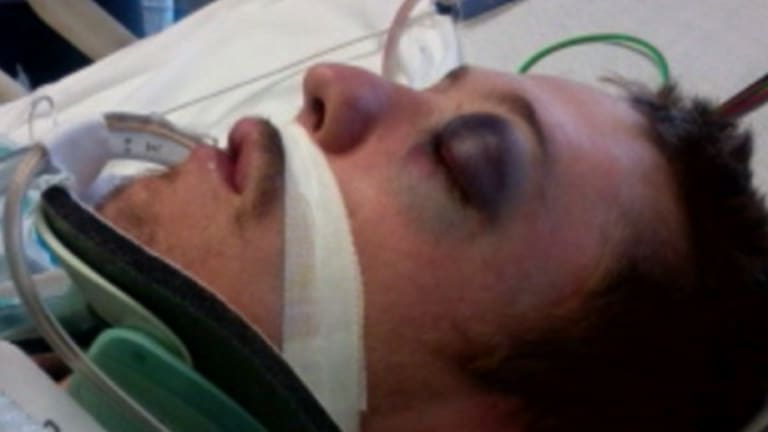Fracturing a Handcuffed Man's Eye Socket is Fine, Just Don't Use Fowl Language While You Do It