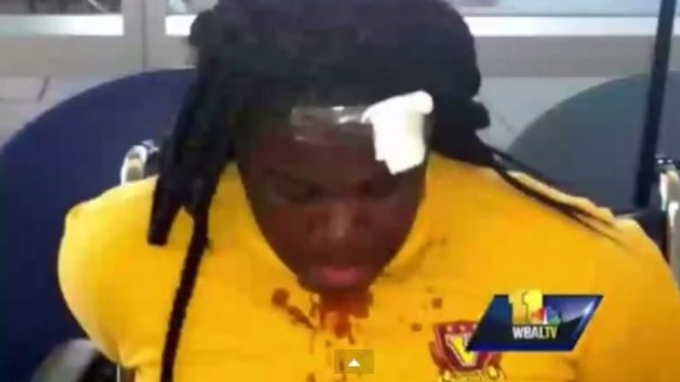 Video Captures Cop Beating a 13-year-old Girl With Baton, Pepper Spraying Two Other Young Girls