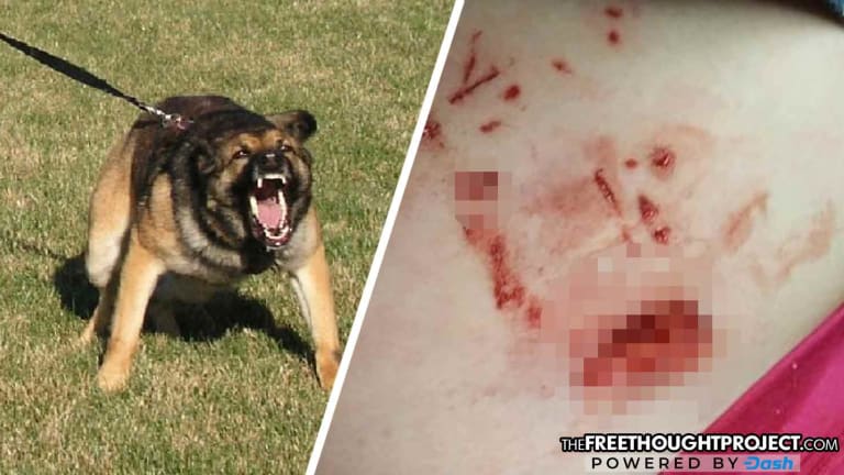 Police K9 Attacks, Seriously Injures 6-Year-old Girl as Witnesses Contradict Cop's Story