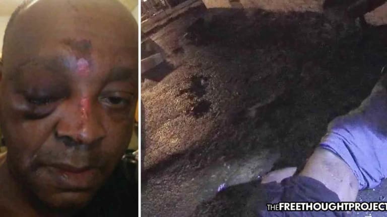 WATCH: 'Get Your Ass Out Here BOY!' Cops Rip Innocent Black Man From His Home, Literally Break His Face