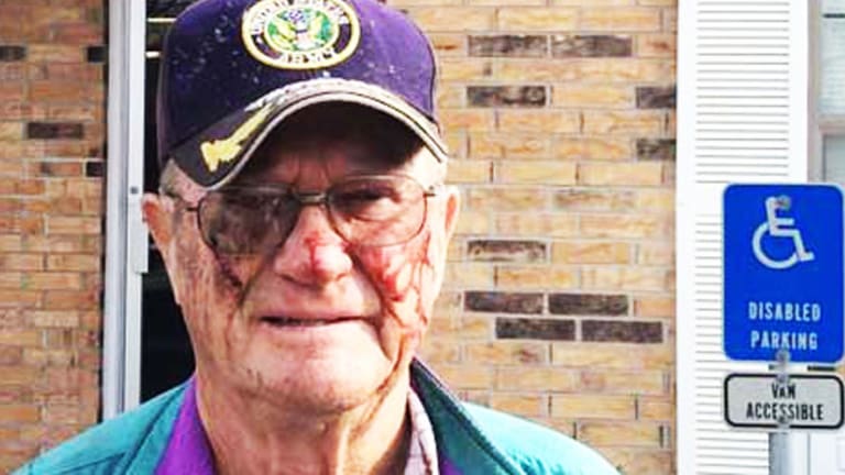 80-Year-Old Army Vet and Cancer Survivor, Mercilessly Beaten By Police Who "Feared For Their Lives"