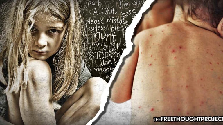 As Media Freaks Over 159 Measles Cases, Thousands of Kids Sold as Sex Slaves Out of Foster Care