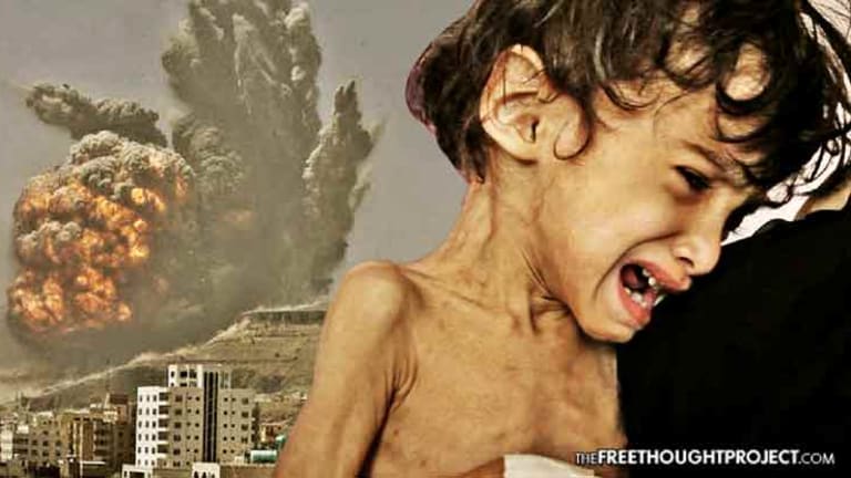 The US is Aiding a Genocide by Mass Starvation in Yemen, Mainstream Media Silent