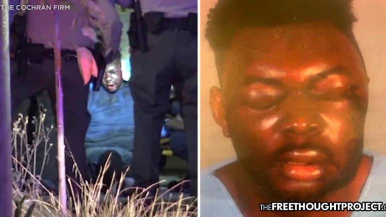 'He Doesn't Look Human': Innocent Man Left Blind & Disfigured After 7 Cops Beat Him Nearly to Death
