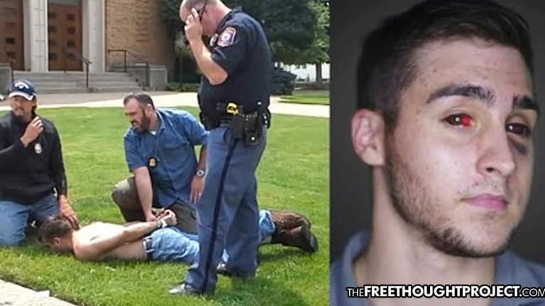 WATCH: Cops Beat Innocent Student Nearly to Death—Claim 'Immunity' to Get Away With It