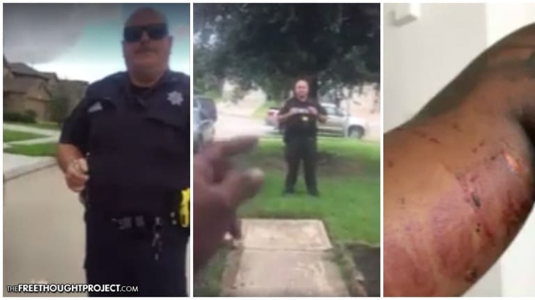 WATCH: Teen Harassed By Cops, Mauled By Police K9 For Mowing Grass