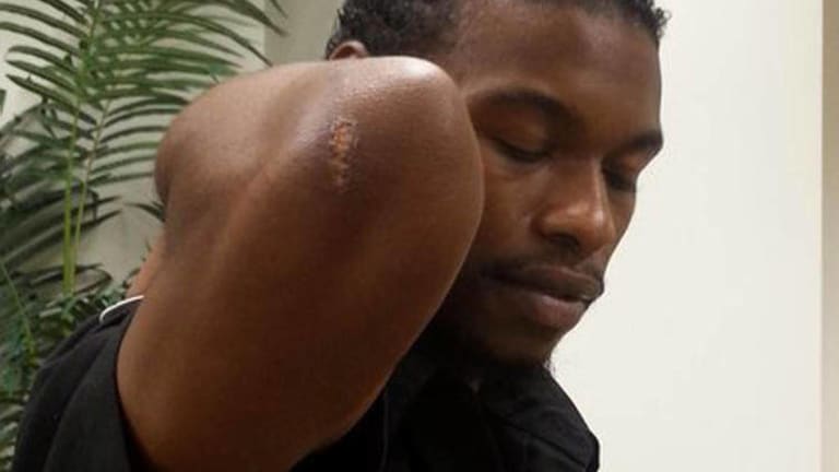 LAPD Brutally Beat, Kicked, Tased Handcuffed Man on Video and Refuse Transparency