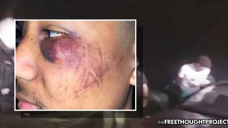 Cops Arrested After Beating Teen So Violently, They Left Boot Marks on His Face — For a Speeding Ticket