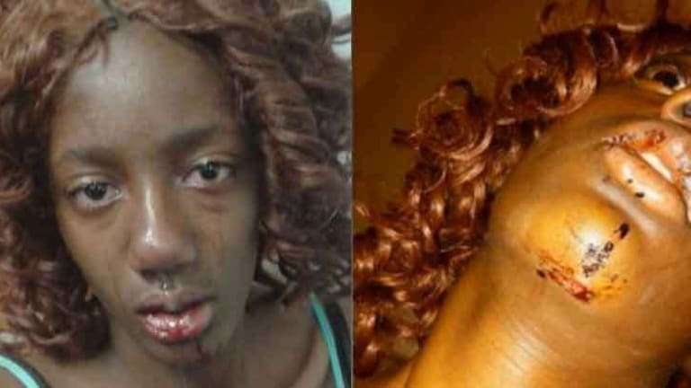 High School Girl Has Jaw Broken by School Cop After Being Falsely Accused of Having Mace