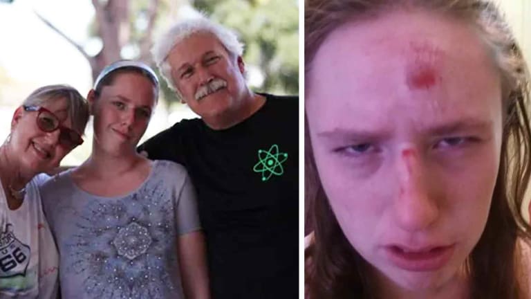 Cops Claim They Had to Smash Innocent Autistic Teen's Head Into Concrete to "Protect Her"