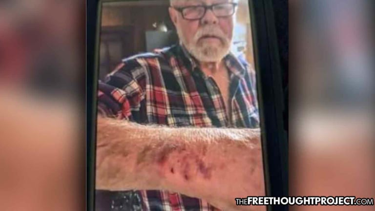 Cops Choke, Beat Elderly Disabled Veteran, Saying, 'This is How They Taught Me in School'