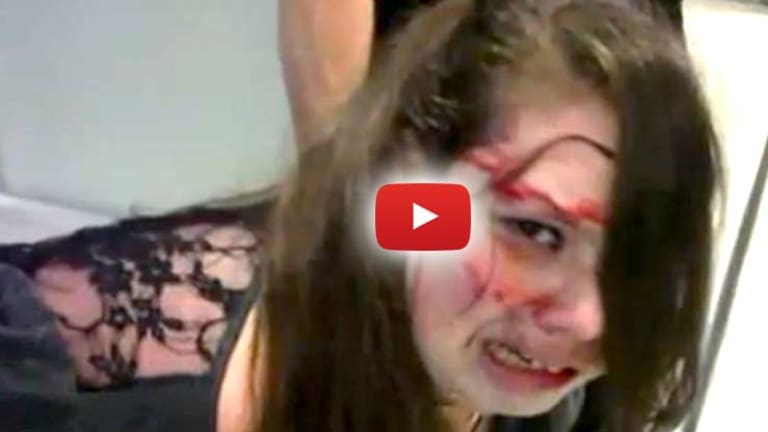 Disabled Teen Beaten Bloody By TSA Agents After Intrusive Search Confused and Frightened Her