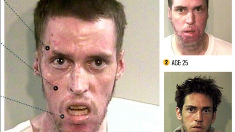 Faces of Meth: The Horrifying Reality of this Brutal Drug Addiction