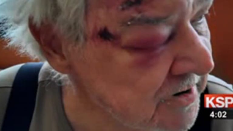 Elderly Man Calls 911 for an Ambulance for His Wife, Cops Show Up First and Beat Him