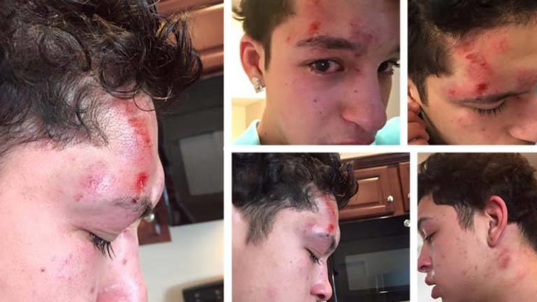 School Cop Destroys 15-yo Student's Face After He Tried to Call his Mom During Lunch