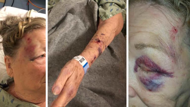 Innocent 84yo Grandmother Assaulted by Police as They Did a Welfare Check on Her Neighbor