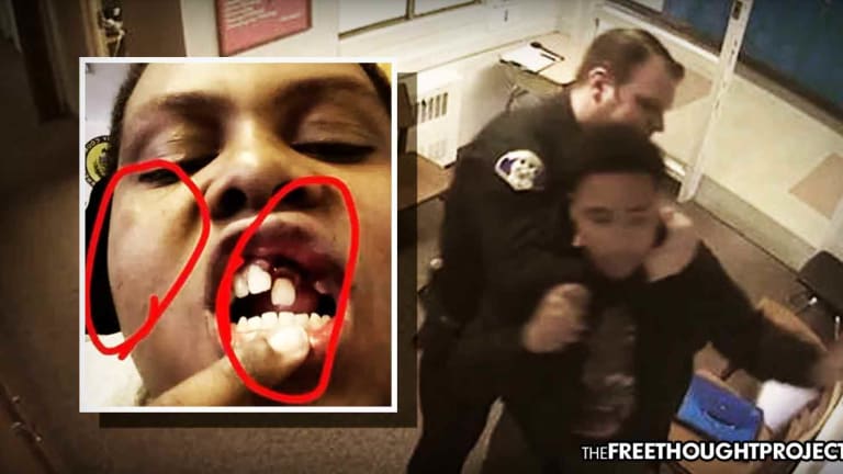 Taxpayers Held Liable After Video Showed School Cop Knock Child's Teeth Out for No Reason