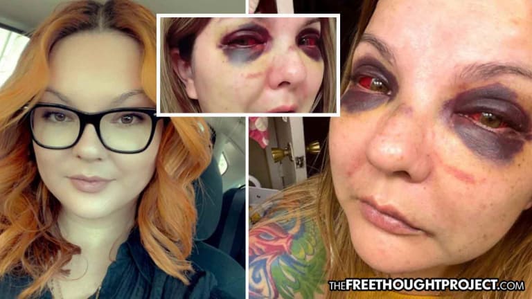Cops Accuse Innocent Sober Mom of Being DUI, Beat Her to Bloody Pulp in Front of Children