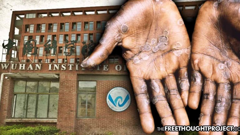 Here's What You WON'T Hear from Corporate Media About the Monkeypox Outbreak