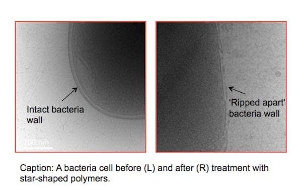 bacteria