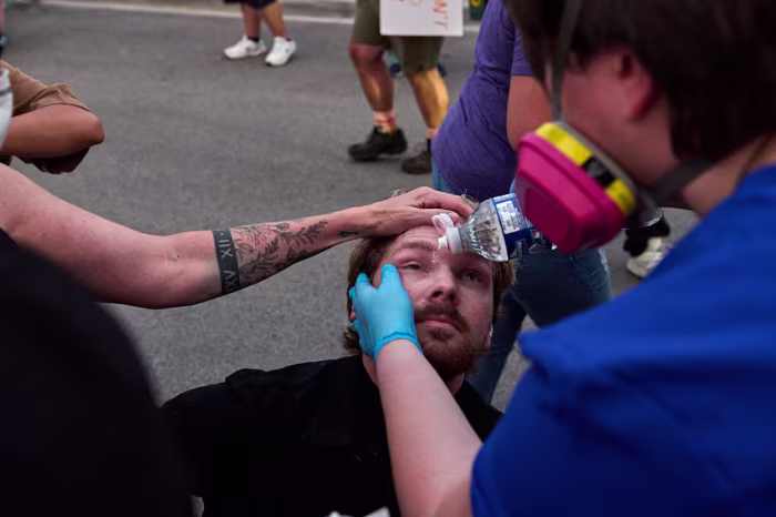 Protesters gathered outside of the suburban Chicago ICE Detention Center in Broadview treat injuries sustained from repeated chemical weapons deployed by federal agents on Sept. 19. | Dominic Gwinn/Middle East Images/AFP/Getty Images