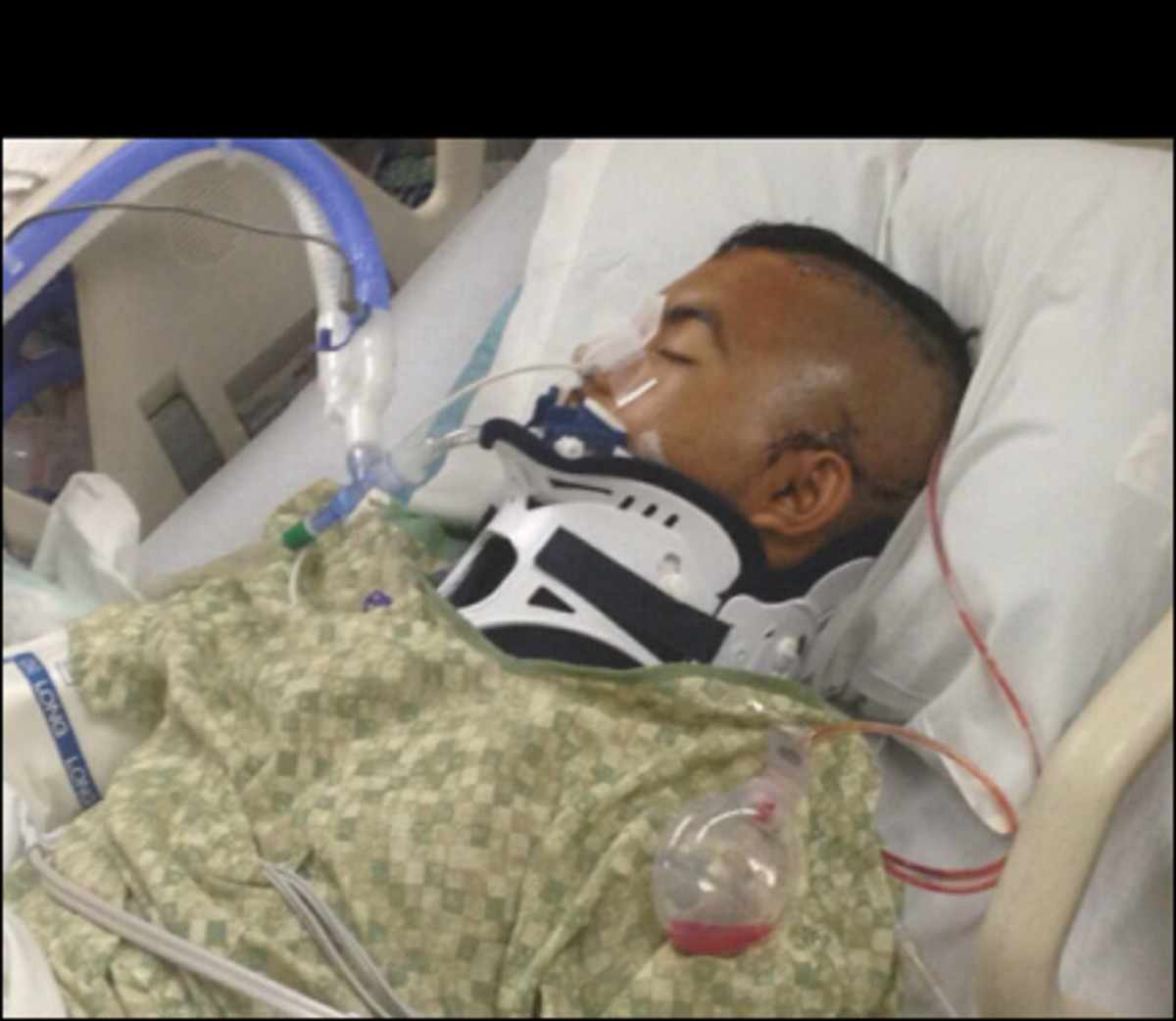 Noe Nino de Rivera in ICU with brain damage / image via Twitter.