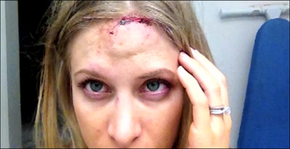 Close up of Woodbury's head injury / Screen capture via KVUE.com.