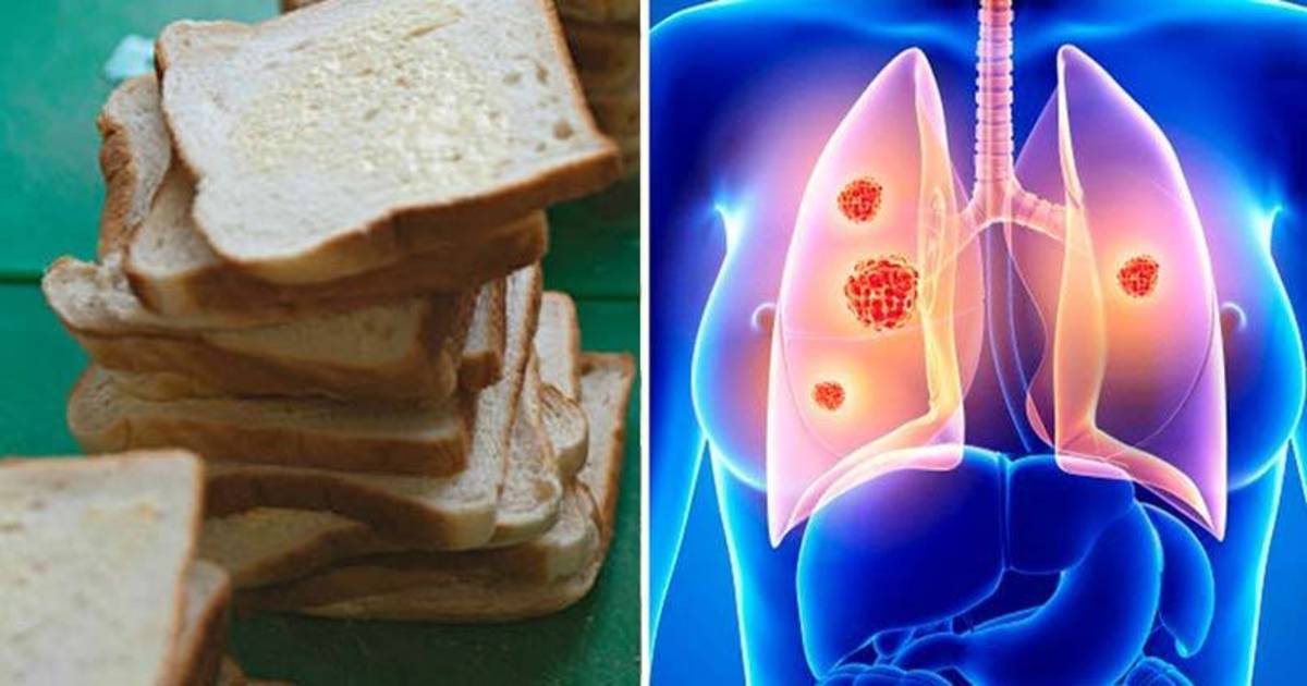 Study Eating White Bread & Bagels Can Be Worse than Smoking 49