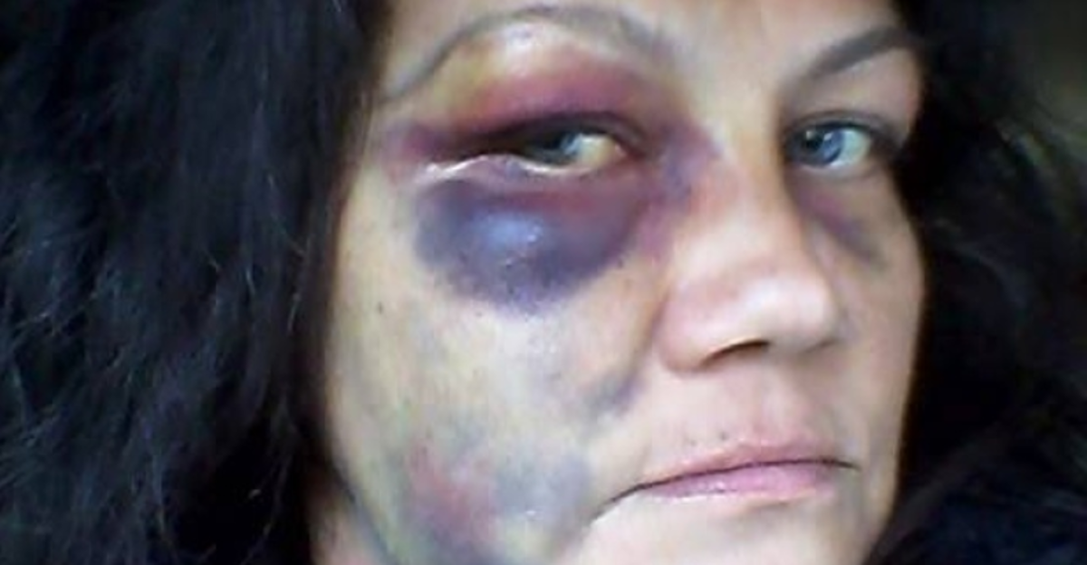 winnepeg cops beat woman
